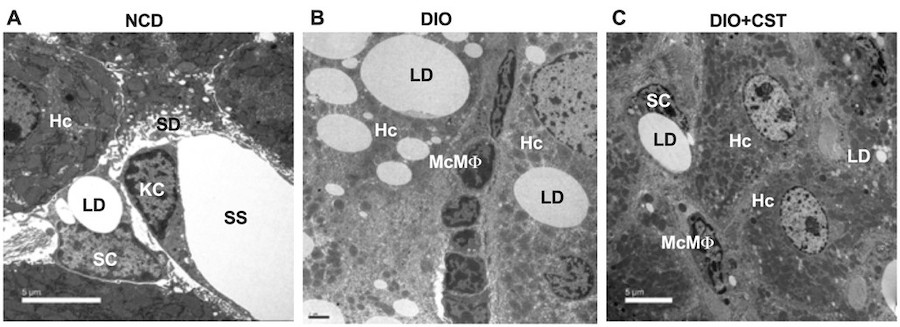 obesity comparison of cells